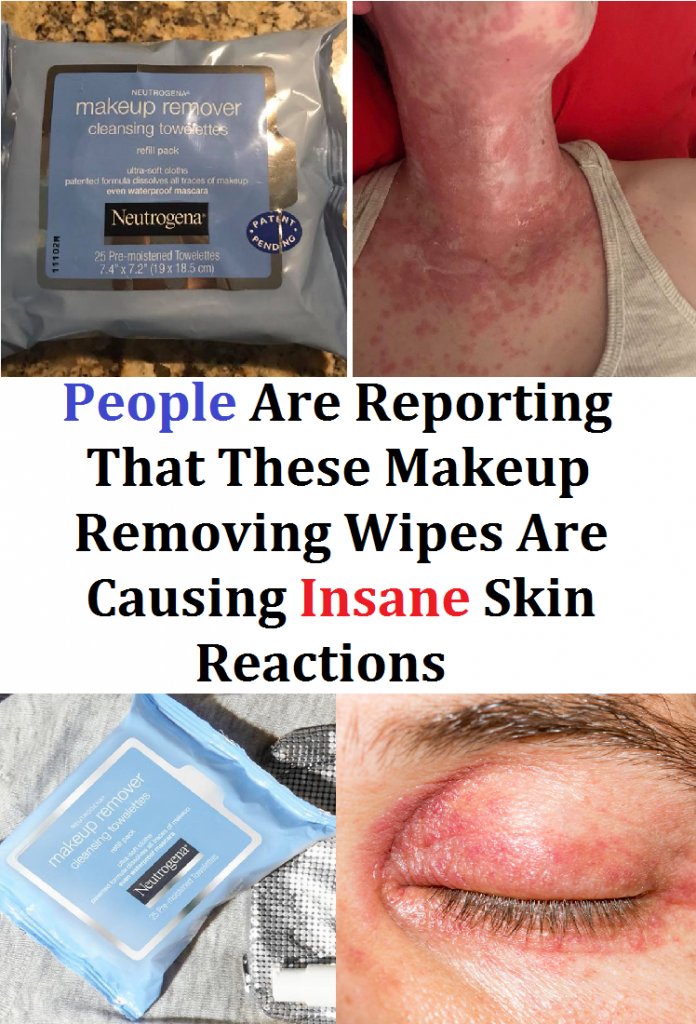 People Are Reporting That These Makeup Removing Wipes Are Causing 